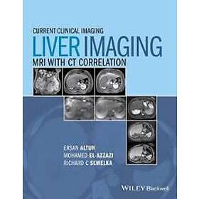 Liver Imaging Hitta B Sta Pris P Prisjakt