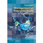Adam Balen: Current Management of Polycystic Ovary Syndrome