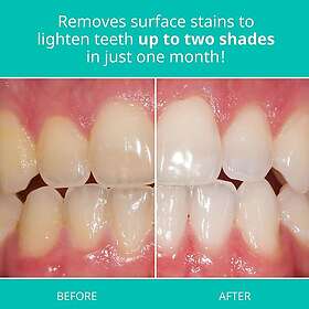 Opalescence Whitening Sensitivity Relief Dentifrice 20ml