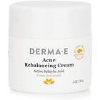 Derma E Acne Rebalancing Cream 56g