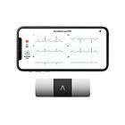 AliveCor Mobilt EKG-system