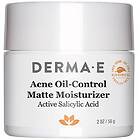 Derma E Acne Oil-Control Matte Moisturizer 56g