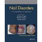 Nail Disorders