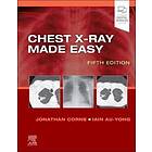 Chest X-Ray Made Easy