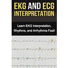 Alyssa Stone: EKG and ECG Interpretation
