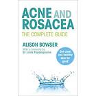 Alison Bowser: Acne and Rosacea