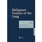 Jean-Paul Sculier, Willard A Fry: Malignant Tumors of the Lung
