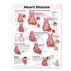 Anatomical Chart Company: Heart Disease Anatomical Chart