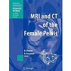 Bernd Hamm, Rosemarie Forstner: MRI and CT of the Female Pelvis