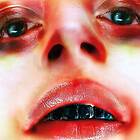 Arca LP