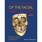 AK Perry: Fractures of the Facial Skeleton 2e