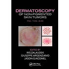 Iris Zalaudek, Giuseppe Argenziano, Jason Giacomel: Dermatoscopy of Non-Pigmented Skin Tumors