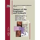 Robert D Odze, Elizabeth A Montgomery, Helen H Wang, Gregory Y Lauwers, Joel K Greenson, Fatima Carneiro, Jason L Hornick: Tumors of the Eso