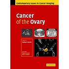 Rodney Reznek: Cancer of the Ovary