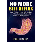 No More Bile Reflux: How to Cure Your Bile Reflux and Bile Gastritis Naturally Without Medications