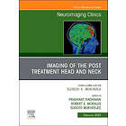 Prashant Raghavan: Imaging of the Post Treatment Head and Neck, An Issue Neuroimaging Clinics North America
