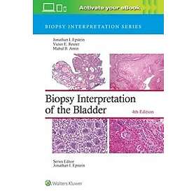 Biopsy Interpretation of the Bladder Engelska Hardback