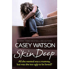 Casey Watson: Skin Deep