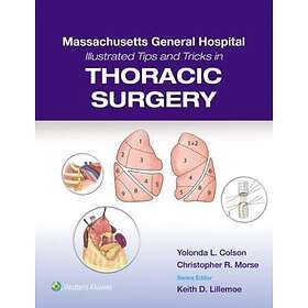 Massachusetts General Hospital Illustrated Tips and Tricks in Thoracic Surgery: 