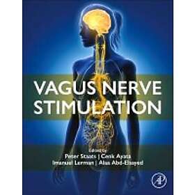 Vagus Nerve Stimulation