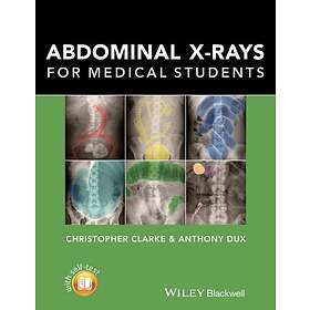 Abdominal X-rays for Medical Students