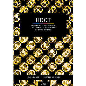 HRCT Pattern recognition and differential diagnosis of lung disease (bok, danskt band, eng)