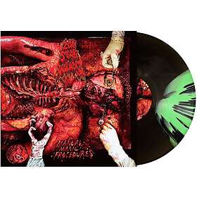 200 Stab Wounds Manual Manic Procedures LP/Vinyl