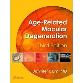 AgeRelated Macular Degeneration
