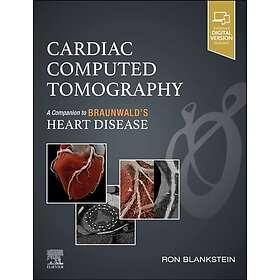 Cardiac Computed Tomography