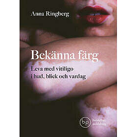 Bekänna färg : leva med vitiligo i hud, blick och vardag