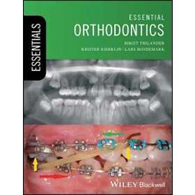 Essential Orthodontics