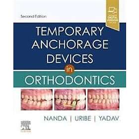 Temporary Anchorage Devices In Orthodontics