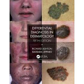 Differential Diagnosis In Dermatology