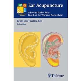 Ear Acupuncture