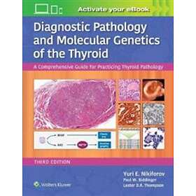 Diagnostic Pathology And Molecular Genetics Of The Thyroid