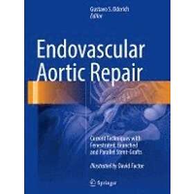 Endovascular Aortic Repair