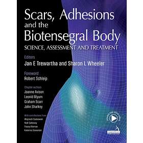Scars, Adhesions And The Biotensegral Body