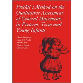 Prechtl's Method On The Qualitative Assessment Of General Movements In Preterm, 