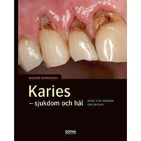 Karies : Sjukdom Och Hål