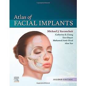 Atlas of Facial Implants