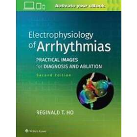 Electrophysiology of Arrhythmias