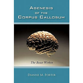 Agenesis of the Corpus Callosum