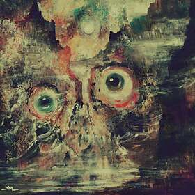 Teratoma Purulent Manifestations CD