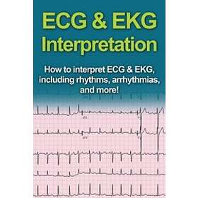 Jeremy Pine: ECG &; EKG Interpretation