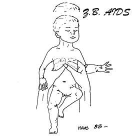 Z.B. Aids Gestalt LP