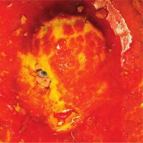 Wackelkontakt - Heal The Split LP