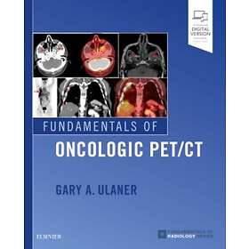 Gary Ulaner: Fundamentals of Oncologic PET/CT