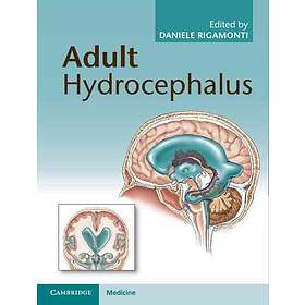 Daniele Rigamonti: Adult Hydrocephalus