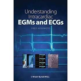 F Kusomoto: Understanding Intracardiac EGMs and ECGs