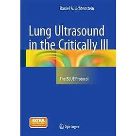 Daniel A Lichtenstein: Lung Ultrasound in the Critically Ill